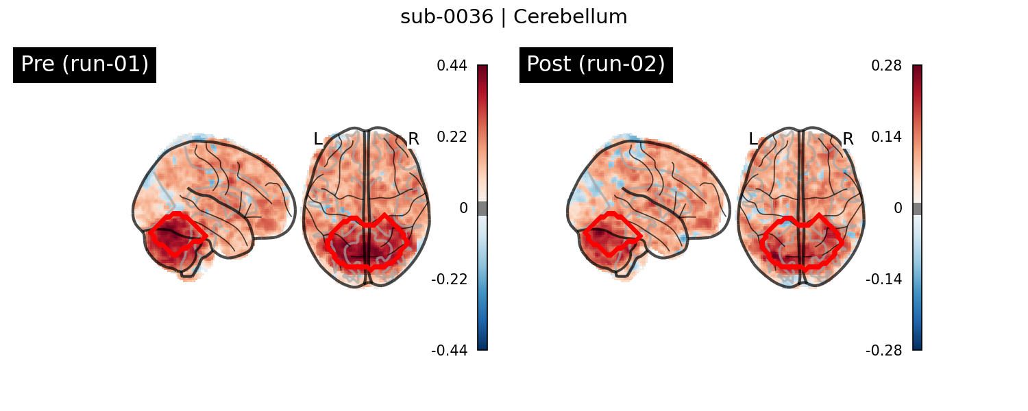 sub-0036_Cerebellum_run-comparison.png