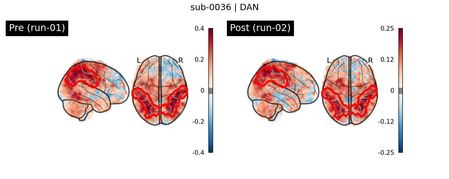 sub-0036_DAN_run-comparison.png