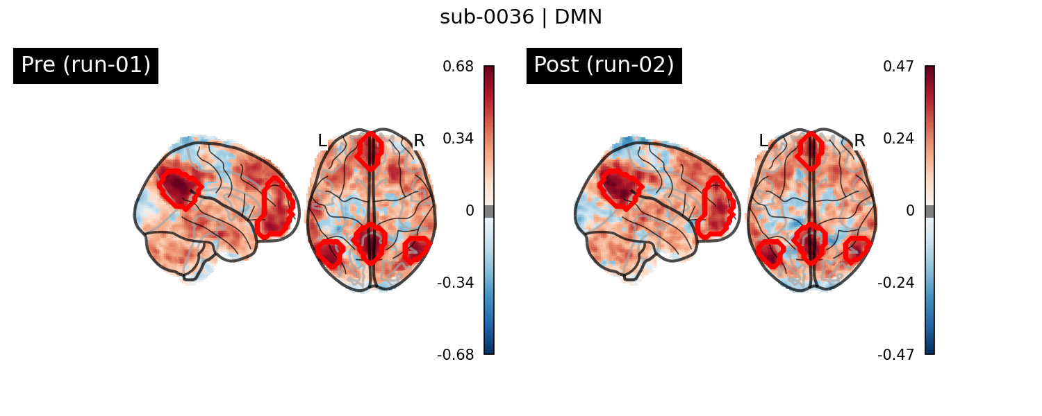 sub-0036_DMN_run-comparison.png