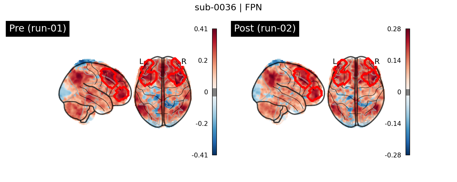sub-0036_FPN_run-comparison.png
