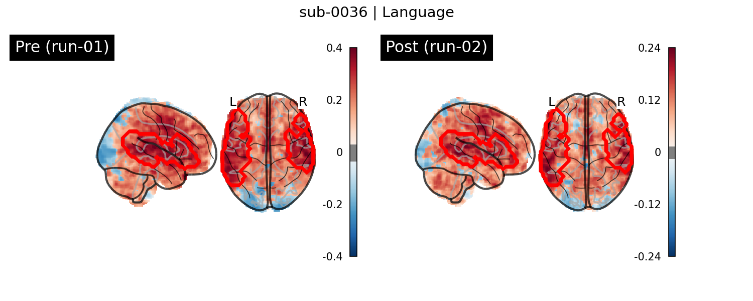 sub-0036_Language_run-comparison.png