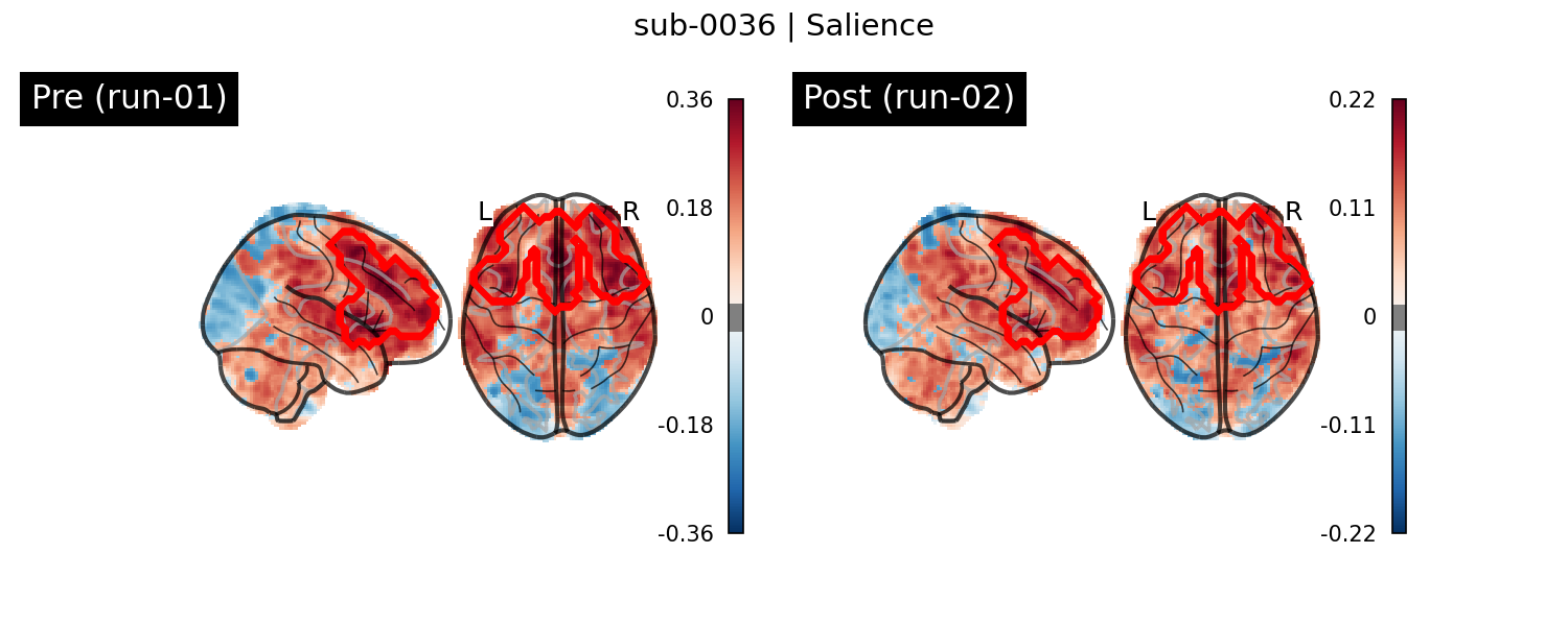 sub-0036_Salience_run-comparison.png