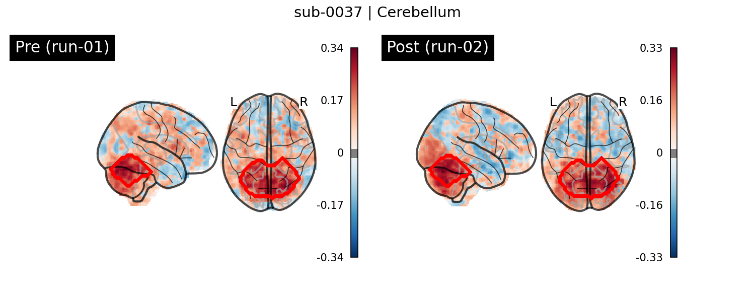 sub-0037_Cerebellum_run-comparison.png