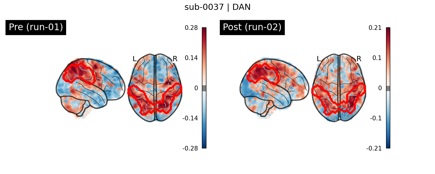 sub-0037_DAN_run-comparison.png