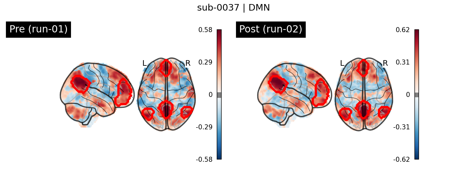 sub-0037_DMN_run-comparison.png
