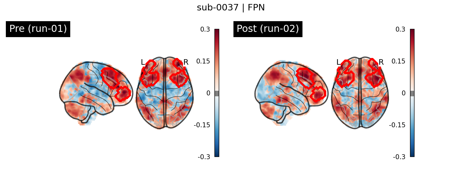sub-0037_FPN_run-comparison.png