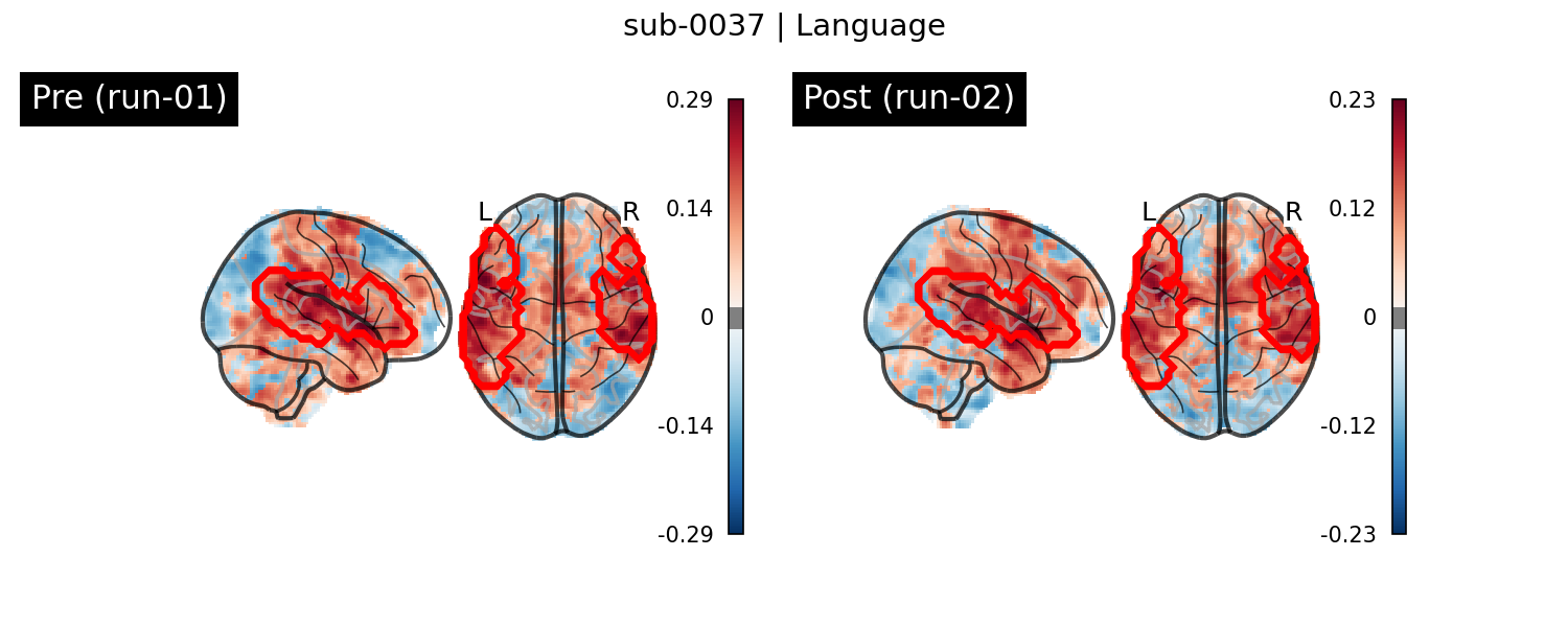 sub-0037_Language_run-comparison.png