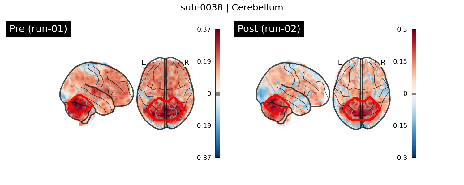 sub-0038_Cerebellum_run-comparison.png