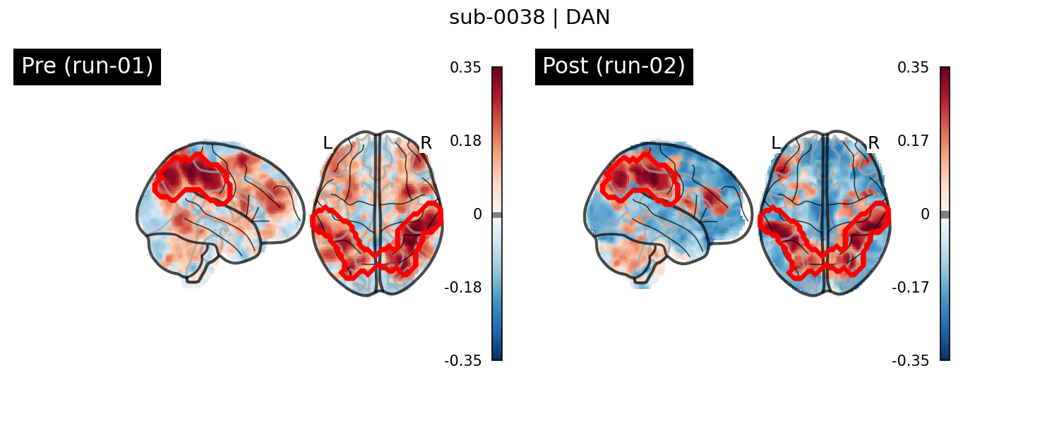sub-0038_DAN_run-comparison.png