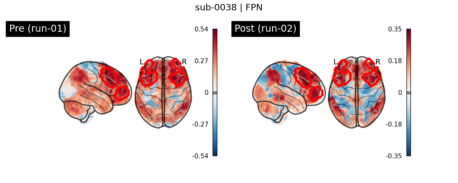 sub-0038_FPN_run-comparison.png