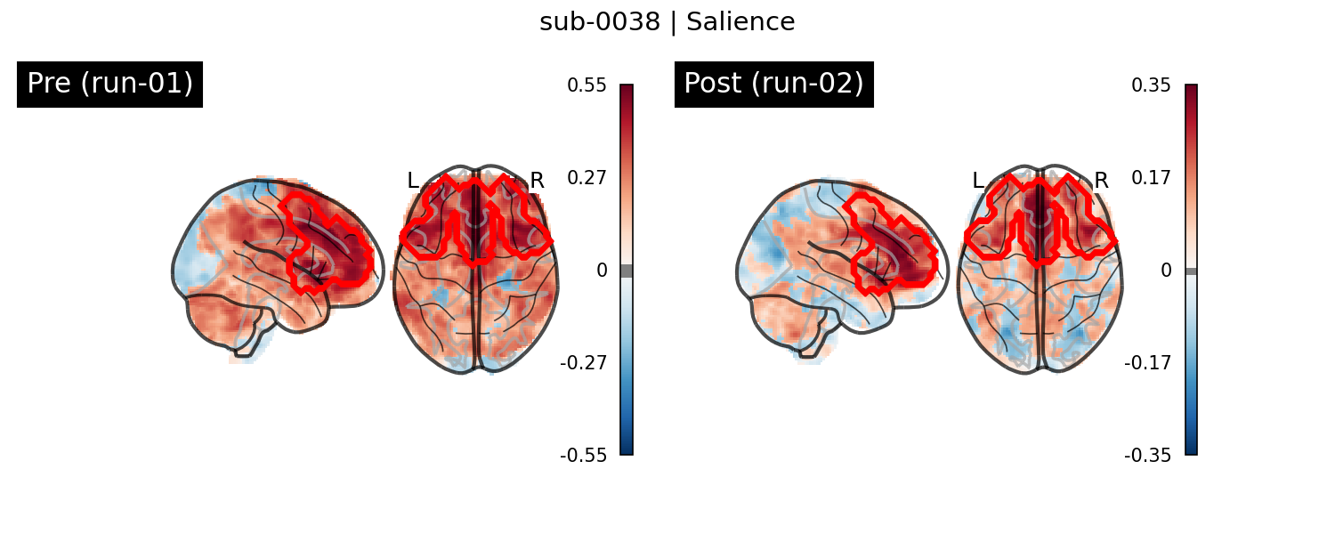 sub-0038_Salience_run-comparison.png