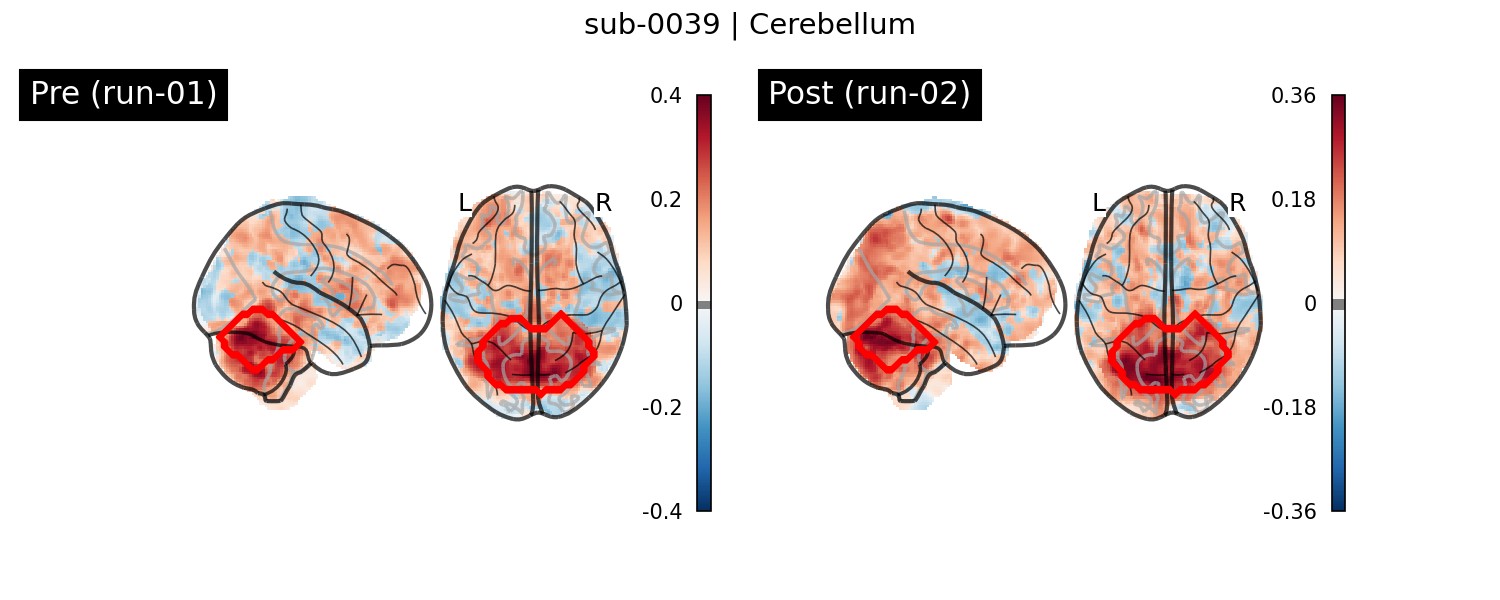 sub-0039_Cerebellum_run-comparison.png