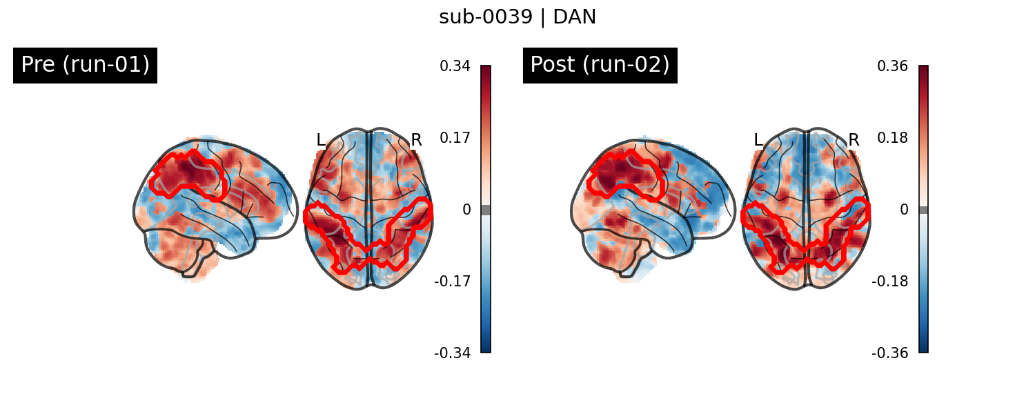 sub-0039_DAN_run-comparison.png