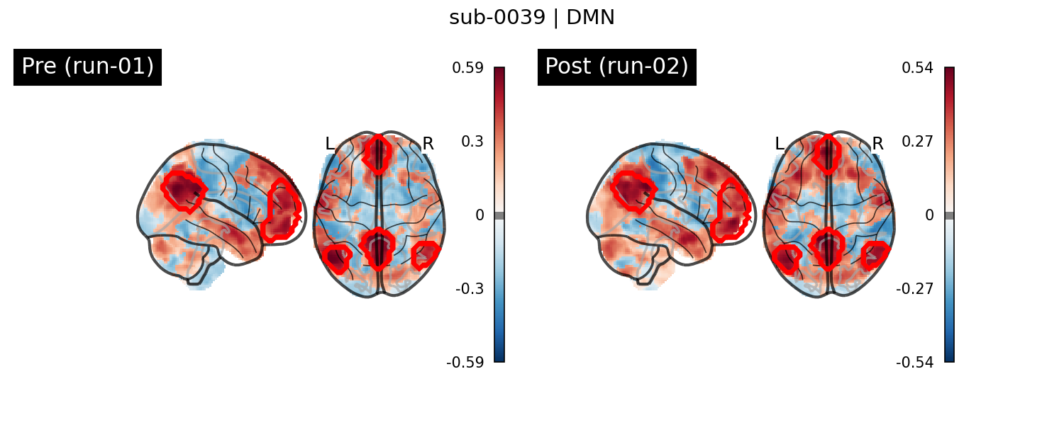 sub-0039_DMN_run-comparison.png