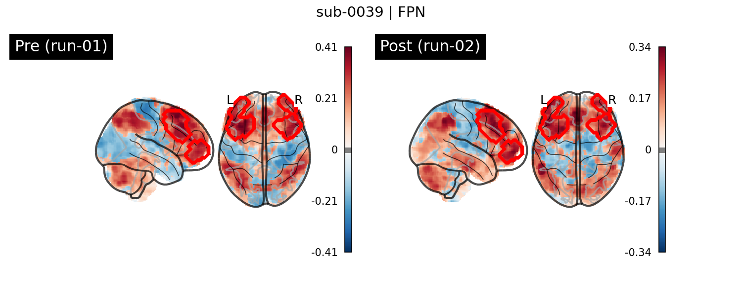 sub-0039_FPN_run-comparison.png