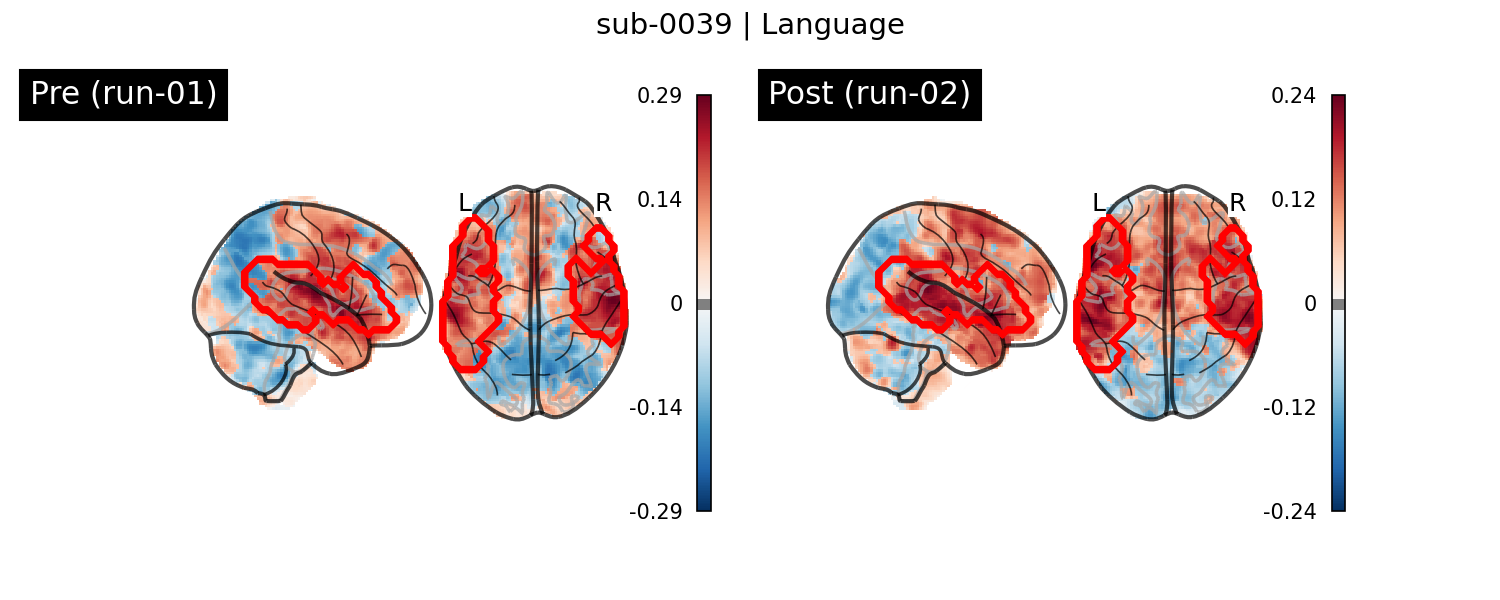 sub-0039_Language_run-comparison.png