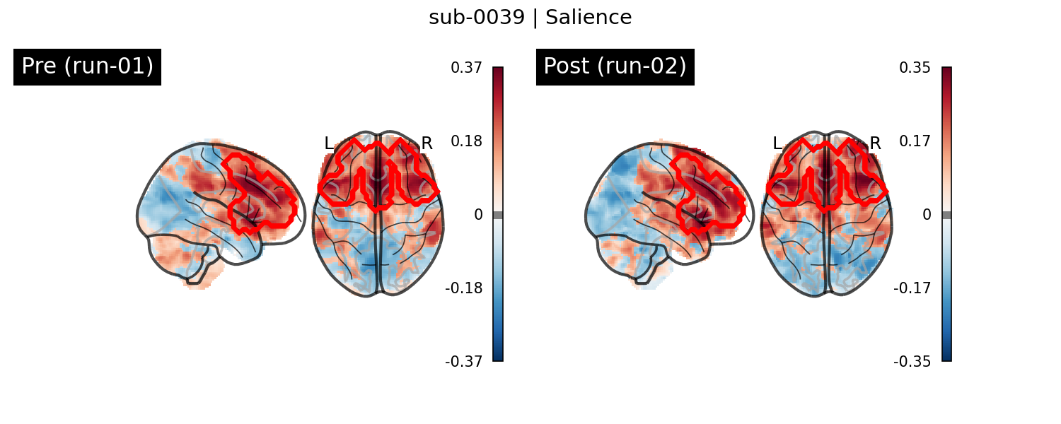 sub-0039_Salience_run-comparison.png