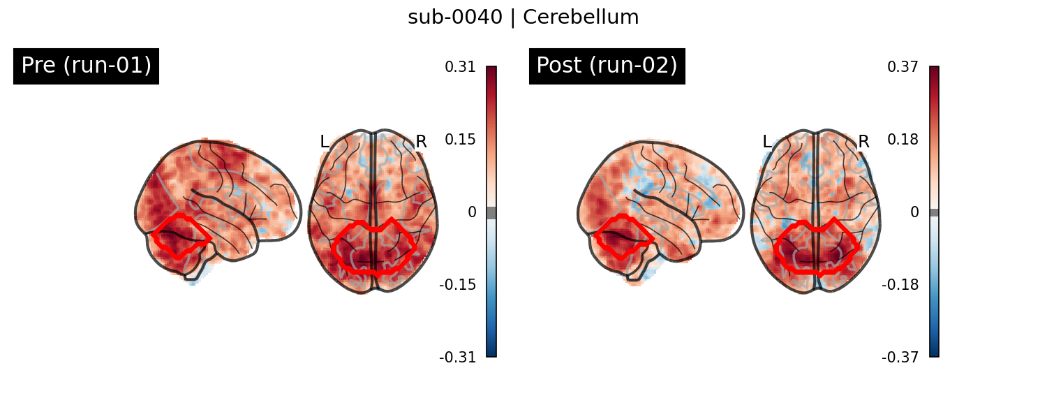 sub-0040_Cerebellum_run-comparison.png