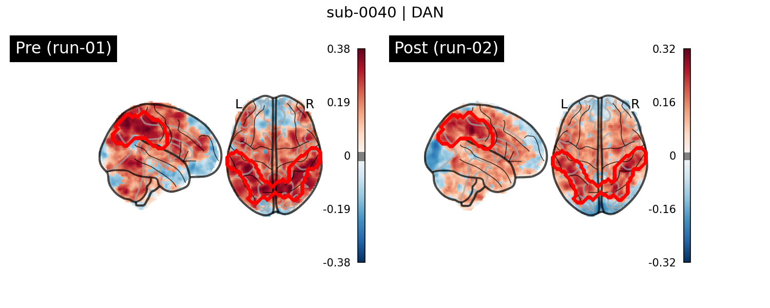 sub-0040_DAN_run-comparison.png