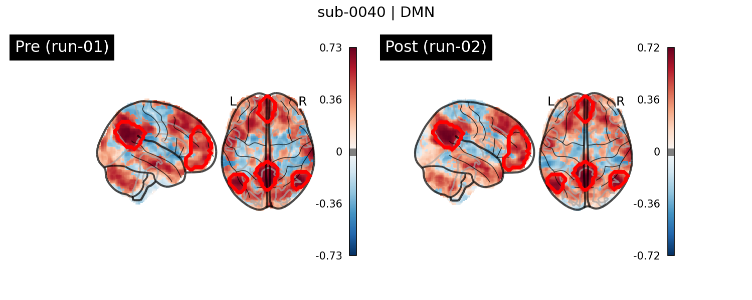 sub-0040_DMN_run-comparison.png