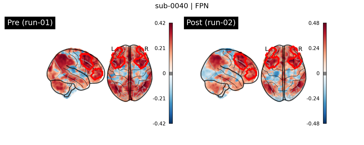 sub-0040_FPN_run-comparison.png