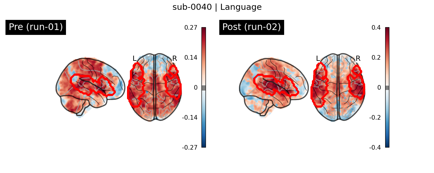 sub-0040_Language_run-comparison.png