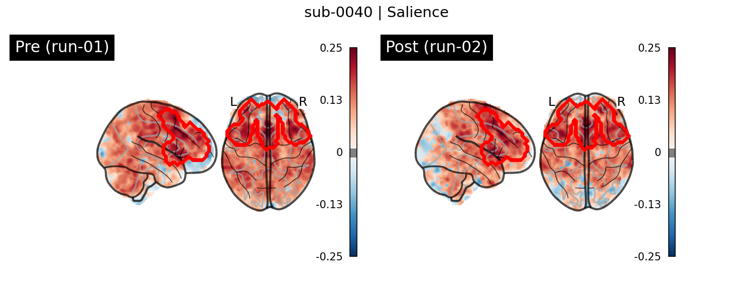 sub-0040_Salience_run-comparison.png