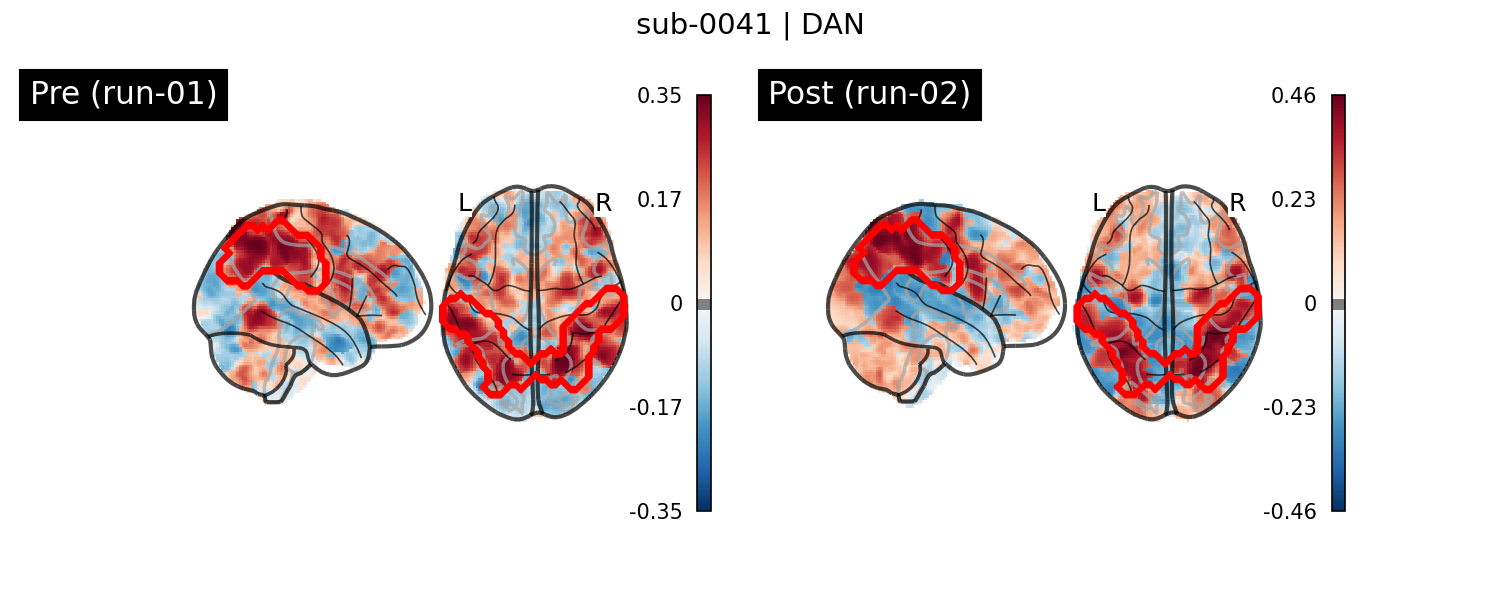 sub-0041_DAN_run-comparison.png