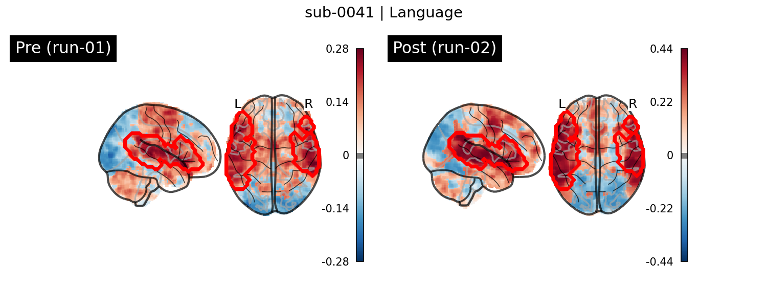 sub-0041_Language_run-comparison.png