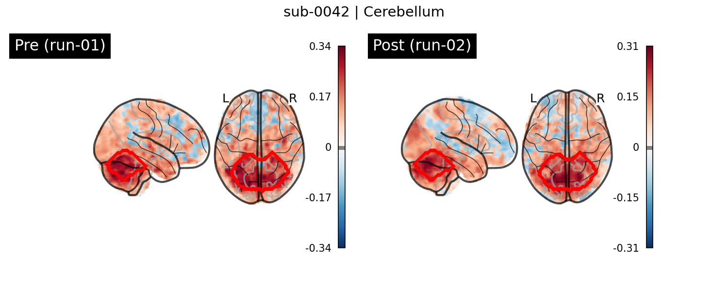 sub-0042_Cerebellum_run-comparison.png