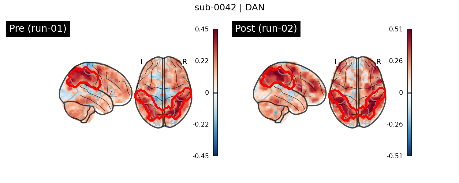 sub-0042_DAN_run-comparison.png