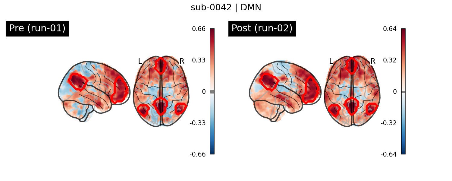 sub-0042_DMN_run-comparison.png
