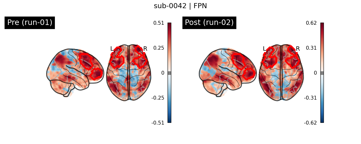 sub-0042_FPN_run-comparison.png
