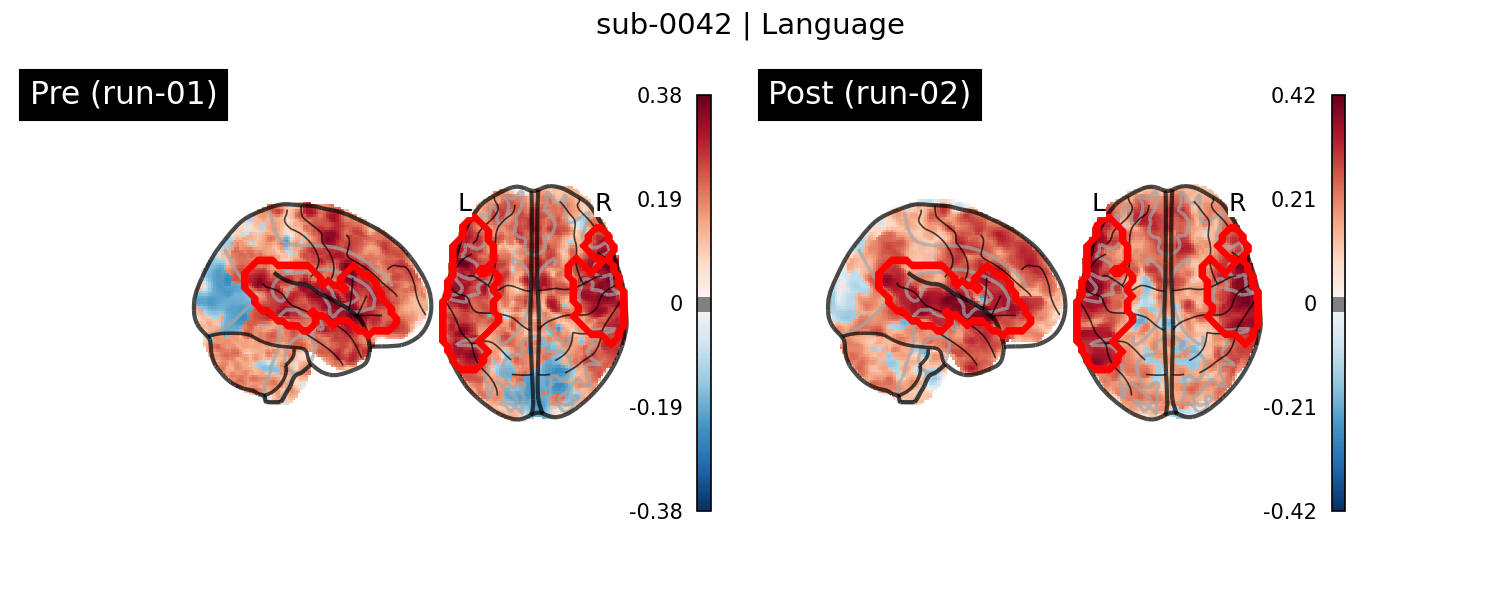 sub-0042_Language_run-comparison.png