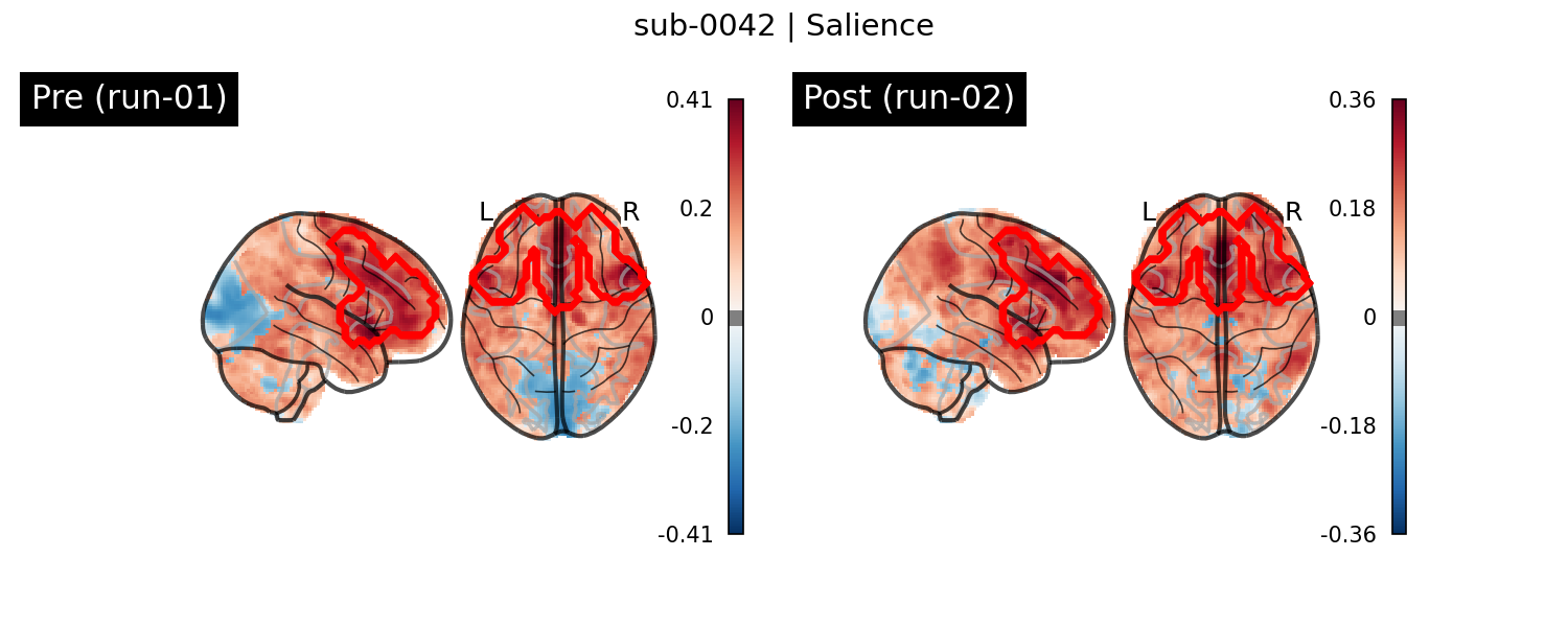 sub-0042_Salience_run-comparison.png