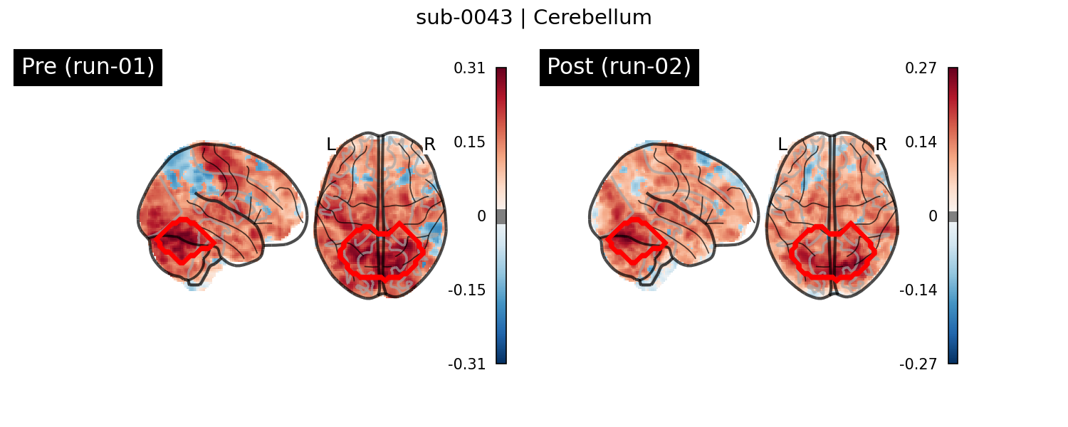 sub-0043_Cerebellum_run-comparison.png