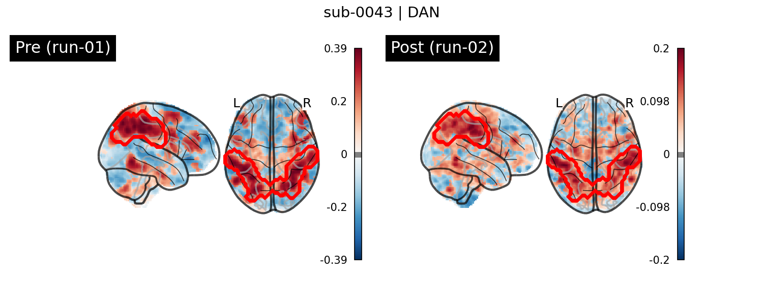 sub-0043_DAN_run-comparison.png