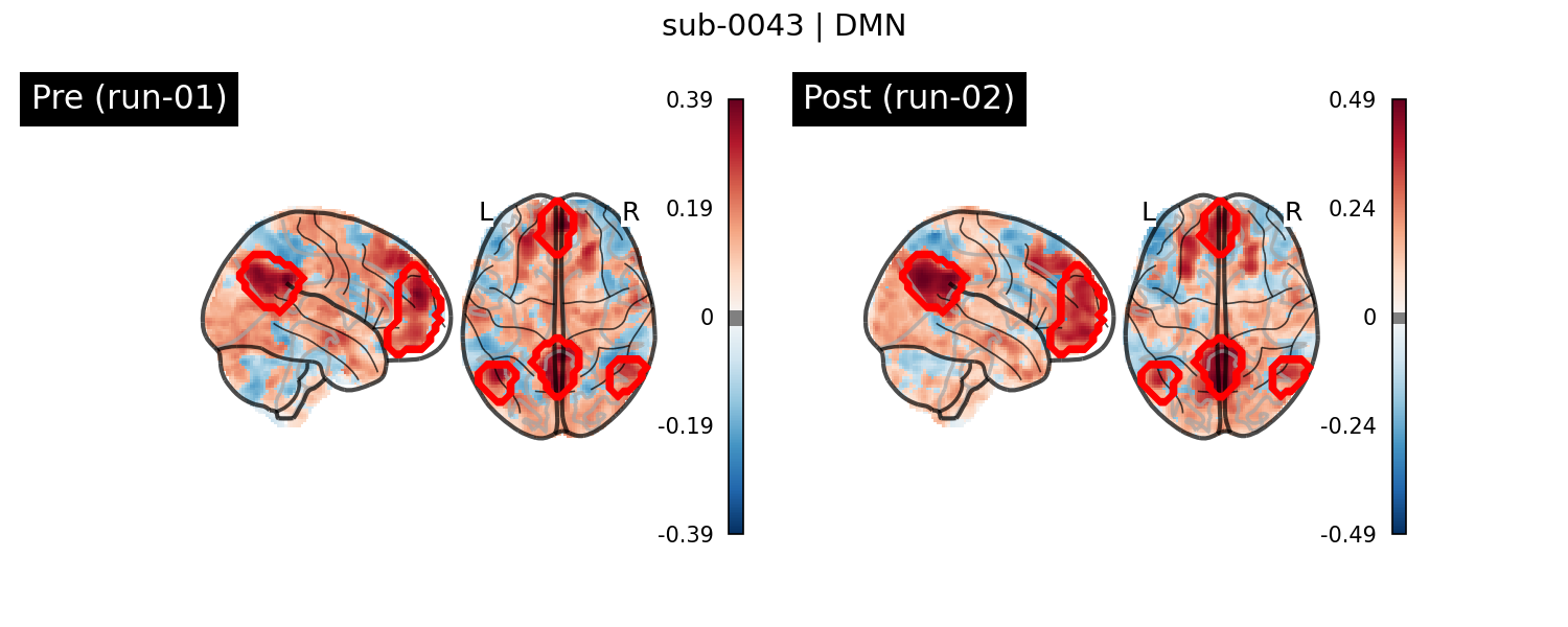 sub-0043_DMN_run-comparison.png
