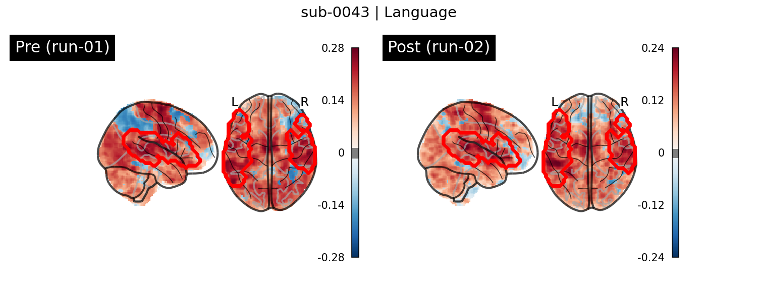 sub-0043_Language_run-comparison.png
