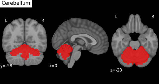 ROI: Cerebellum
